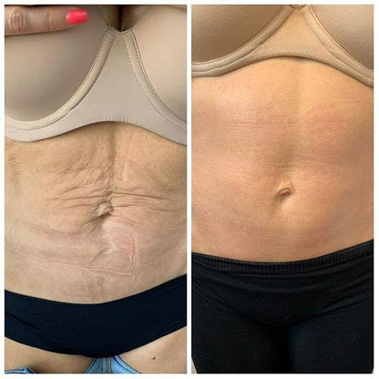 Lusora Red Light Therapy Belt